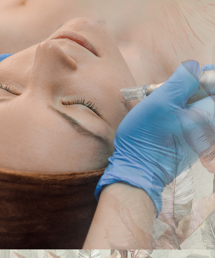 MEZOTERAPIA MIKROIGŁOWA NANOFRAX